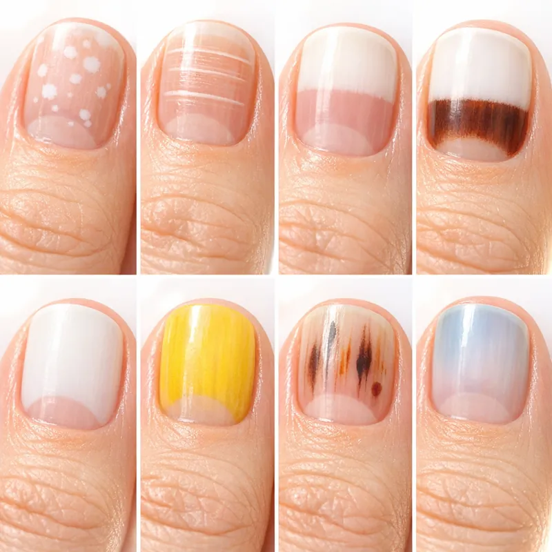 Что ваши ногти могут рассказать о здоровье