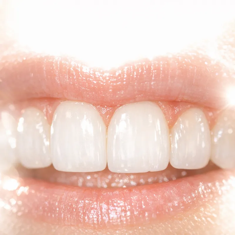 Чёрный ободок вокруг коронки как эстетическая катастрофа