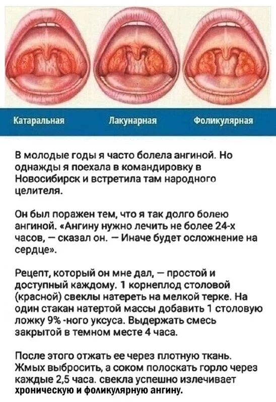 Медицинская инфографика