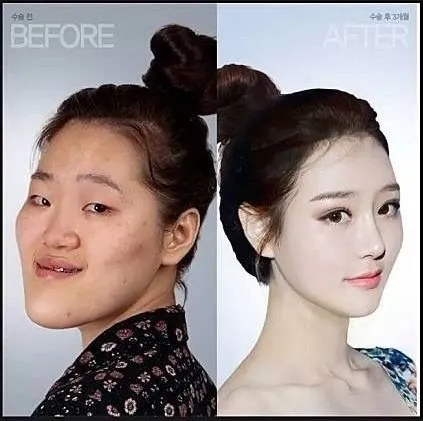 Меня интересует мнение о пластической хирургии...