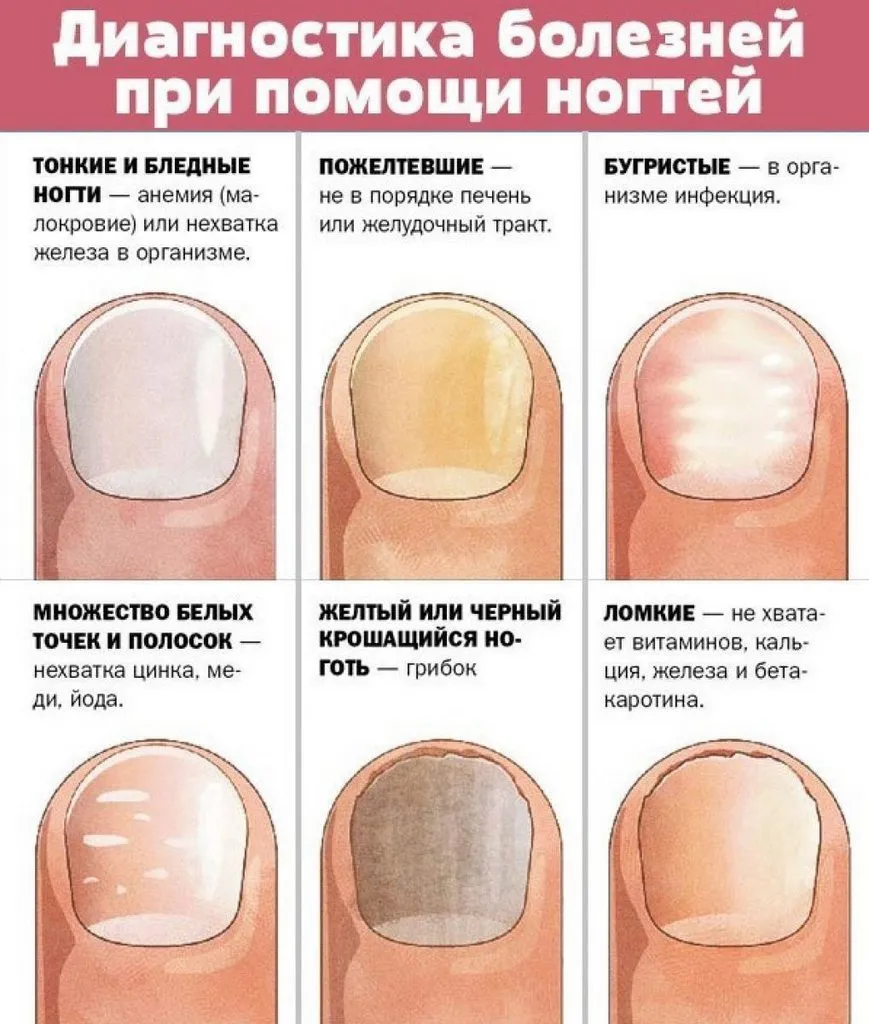 Медицинская инфографика