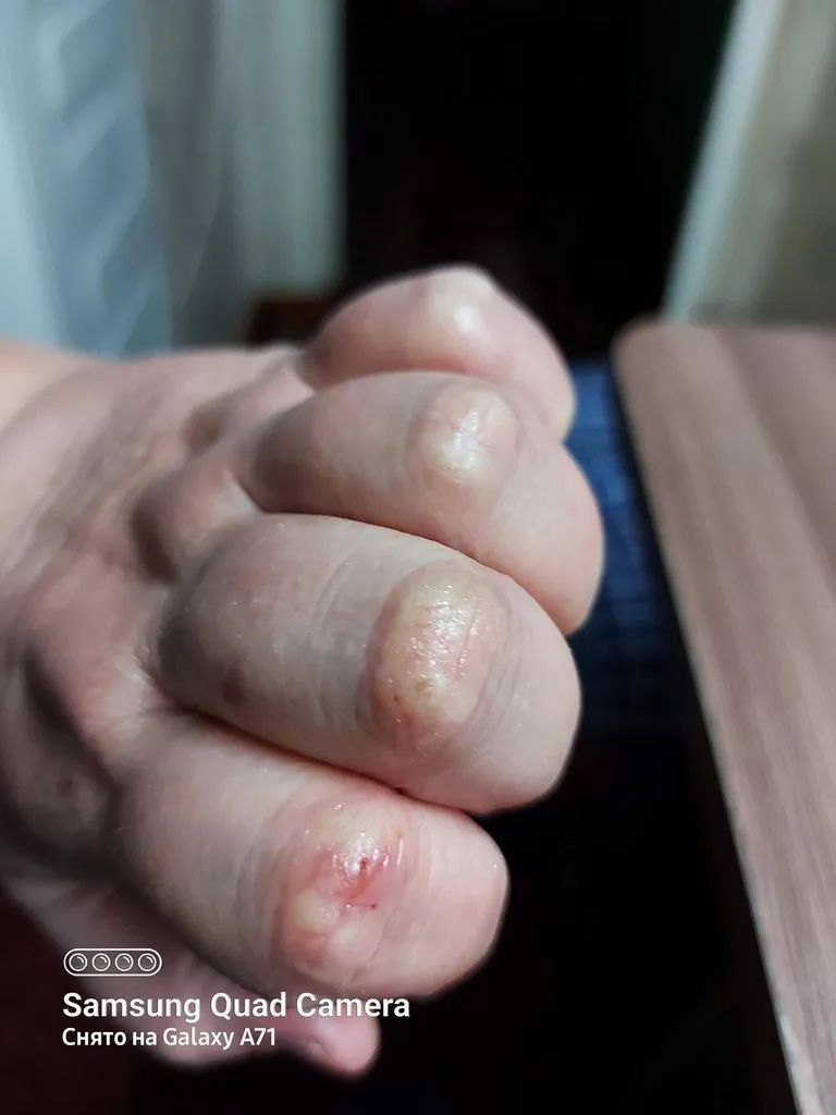 Tapтaлeтки & Ко