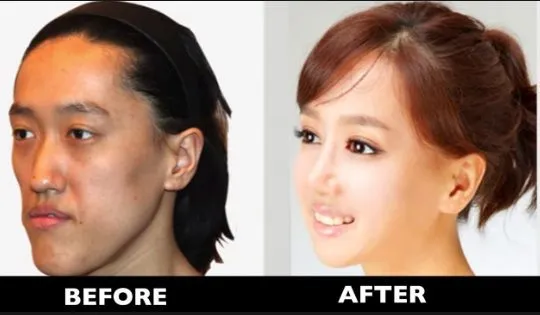 Меня интересует мнение о пластической хирургии...