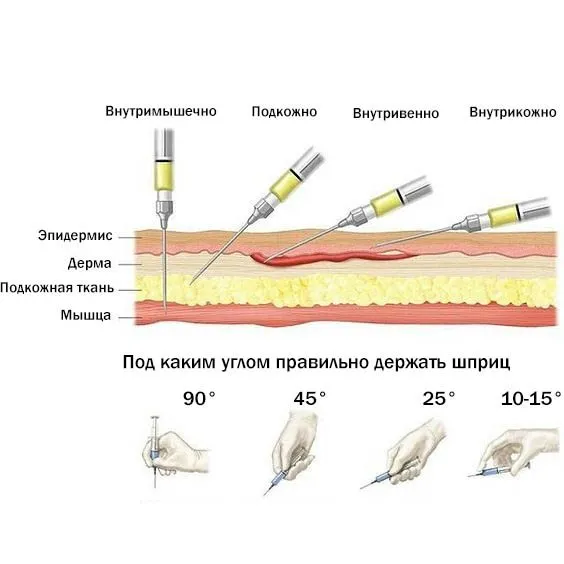 Медицинская инфографика