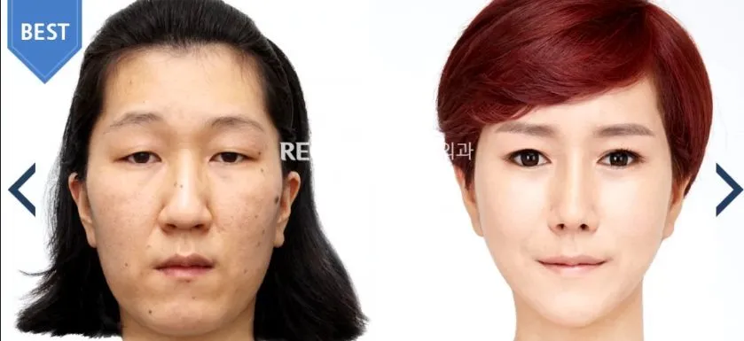 Меня интересует мнение о пластической хирургии...