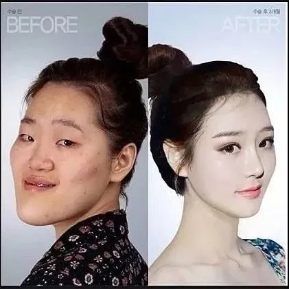 Меня интересует мнение о пластической хирургии...