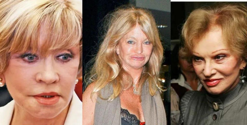 Меня интересует мнение о пластической хирургии...