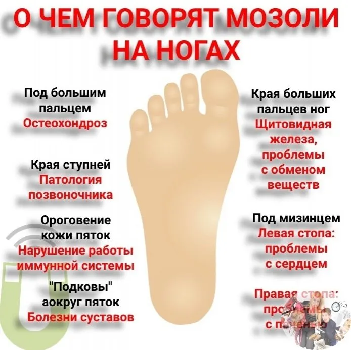 Медицинская инфографика