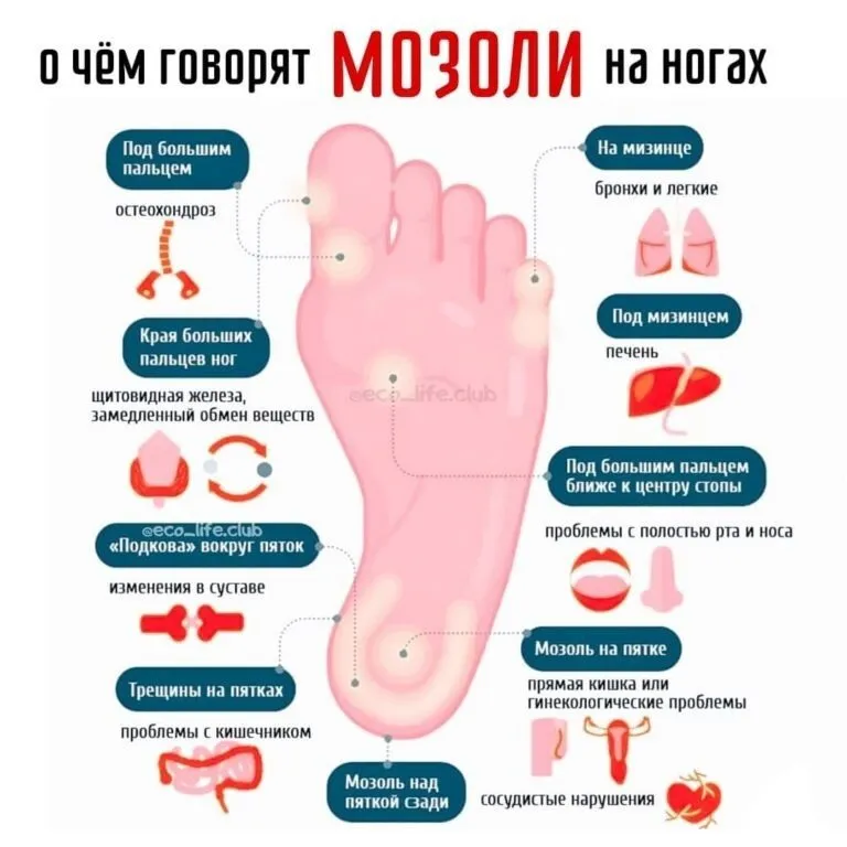 Медицинская инфографика