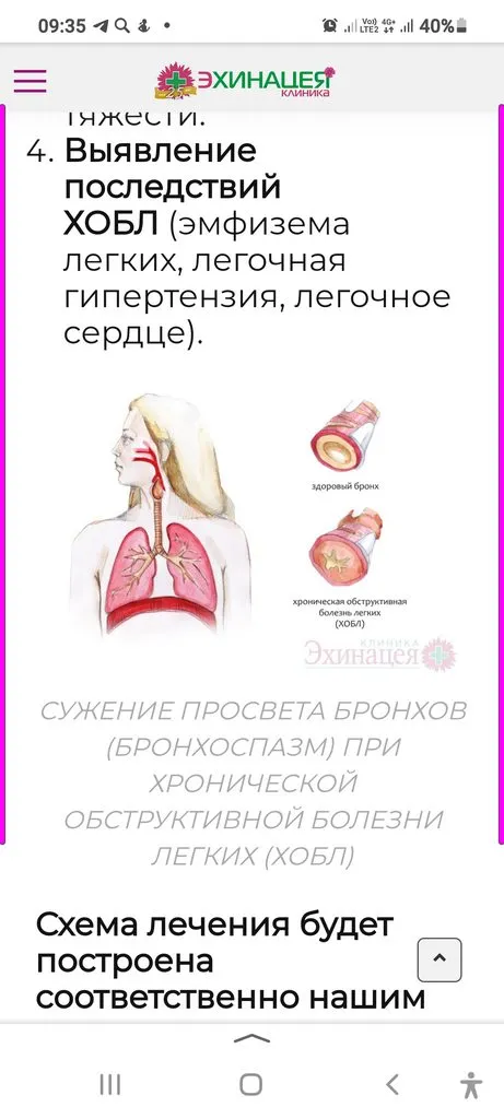 Я и моя астма. Мини-форум для астматиков и сочувствующих