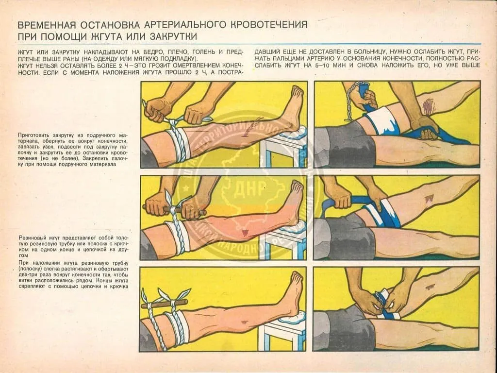 Практические оперативные советы по простому жизнеобеспечению в чрезвычайных ситуациях
