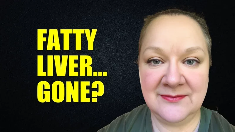 Just a Few Months on Carnivore and This Happened…