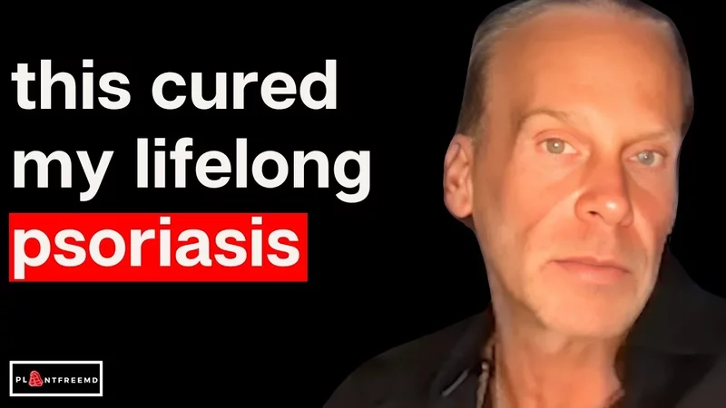 Finding Out The Truth About Psoriasis After 30 Years of Suffering Stephen Lashbrook