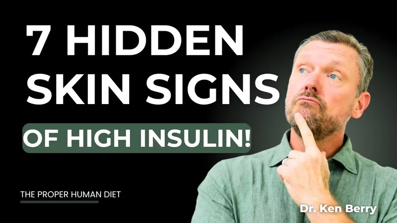 7 Skin Signs of Insulin Resistance (Even If You’re Slim!)
