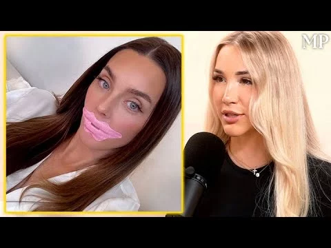 Carnivore Diet & Mouth Taping for Jaw Definition