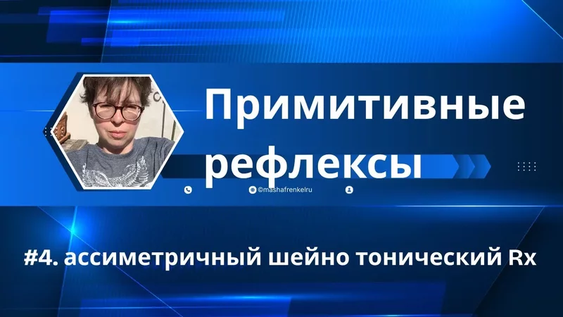 Рука выстреливает вперёд? Это не привычка — это рефлекс!