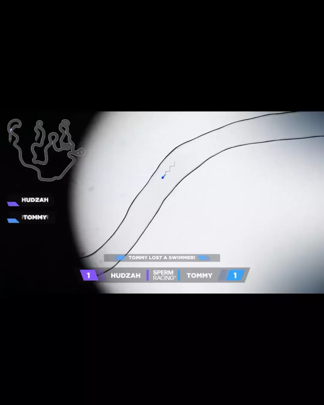 rdt